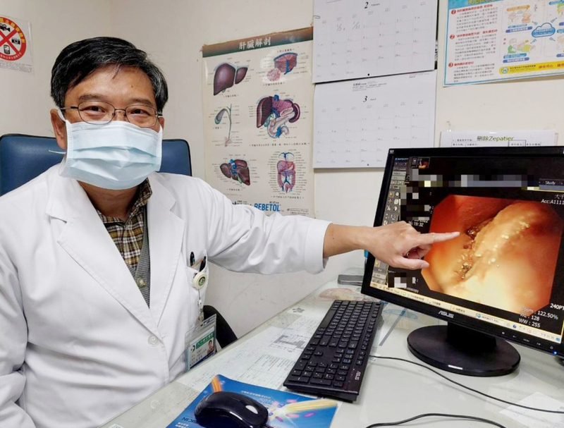 老翁餐後胸痛昏倒 食道塞滿食物1小時才清完