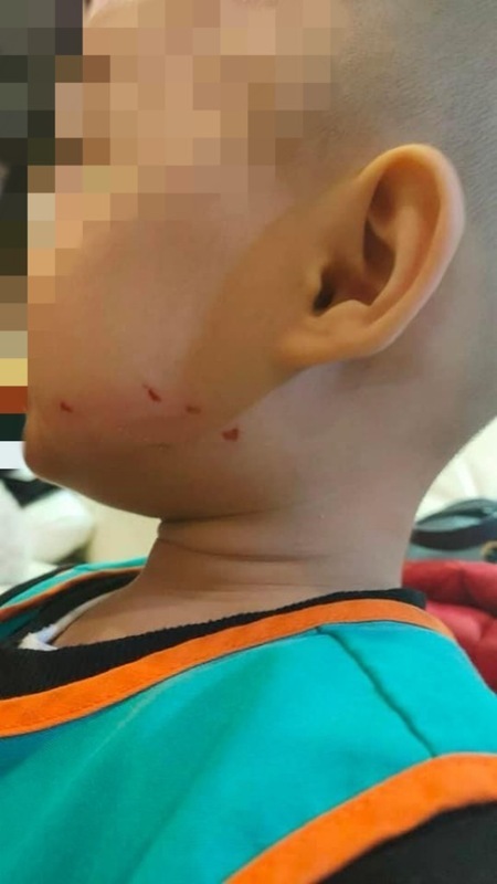 桃園市幼兒園再傳虐兒案 黃瓊慧批張善政只顧助選