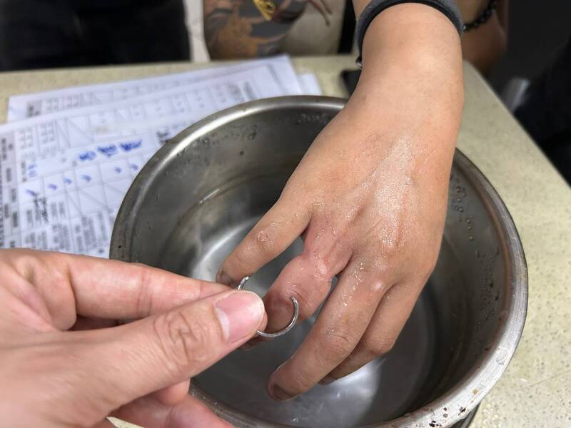 新北孕婦水腫鋼戒卡手指 消防員神救援解套