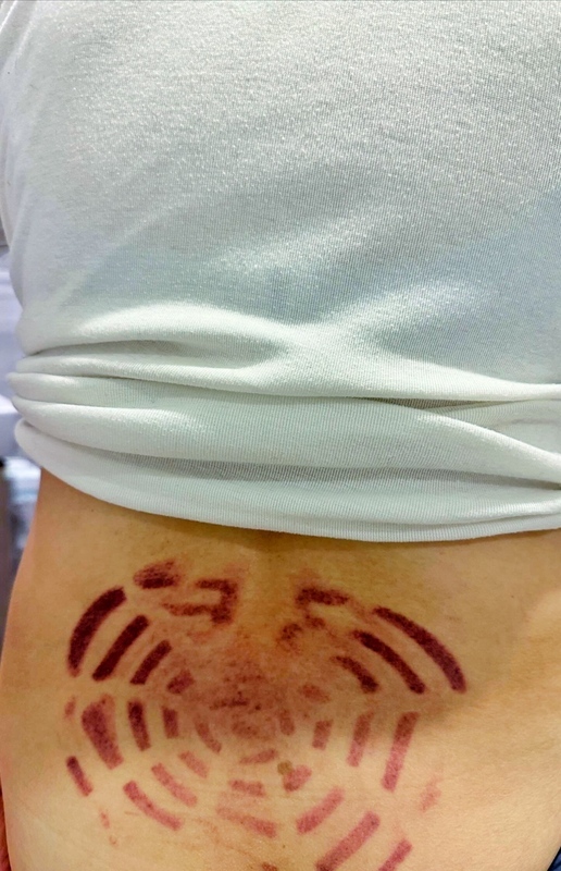 運動中心戲水遭吸出恐怖印痕 黃瓊慧要體育局改善