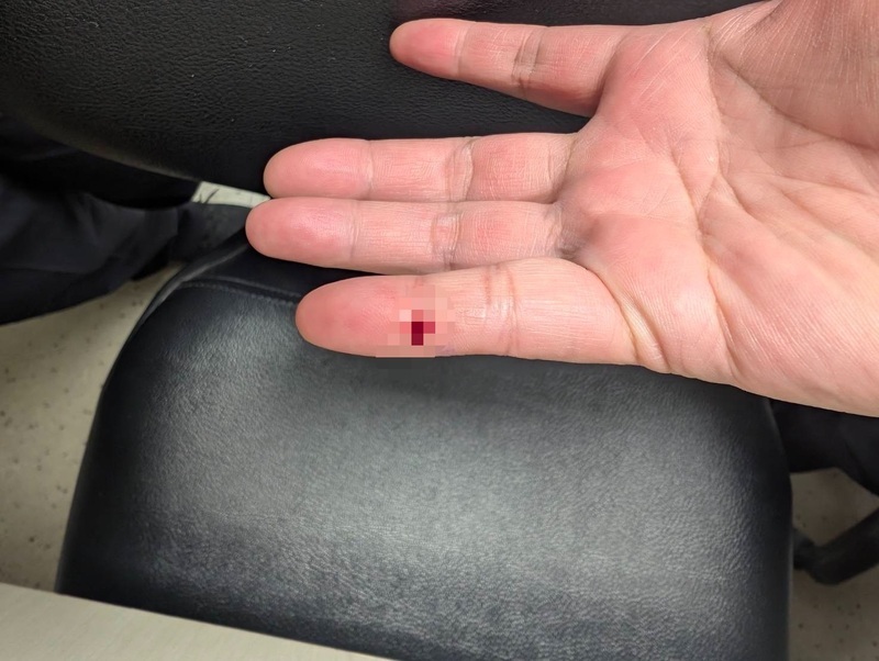 桃機檢疫員遭抽過血針頭扎 議員曝請假疑被刁難