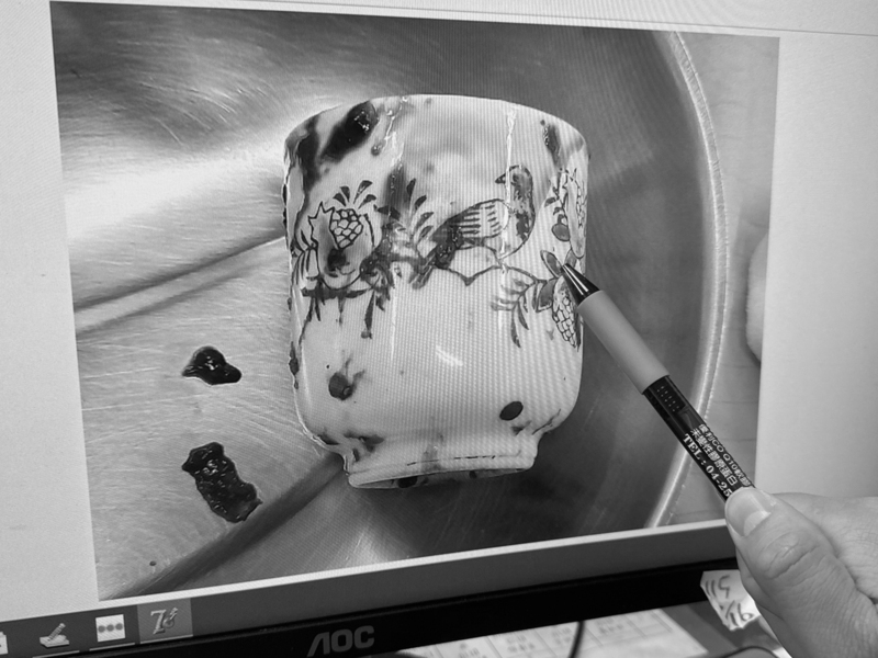 男無法解便就醫驚見肛門塞8公分高陶瓷杯　剖肚取出