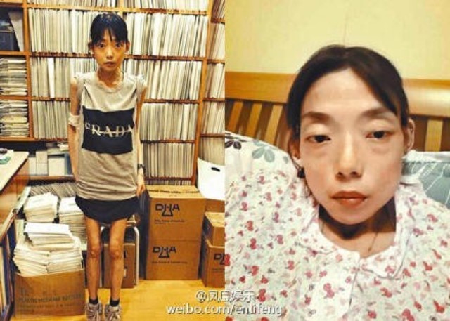 伍智恒和百貨少東郭永淳2000年結婚後，就因病割去大半個胃，還因此需要拄拐杖，更因小三介入，離婚收場。翻攝畫面。翻攝自微博。