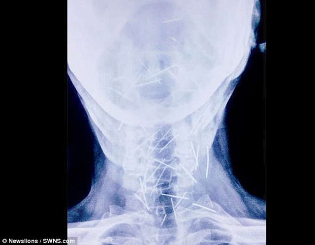 (翻攝每日郵報)