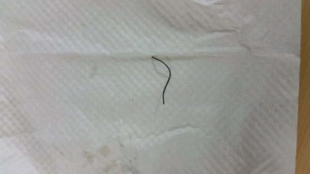 網友吃在路邊買的菜包，竟吃到鐵絲