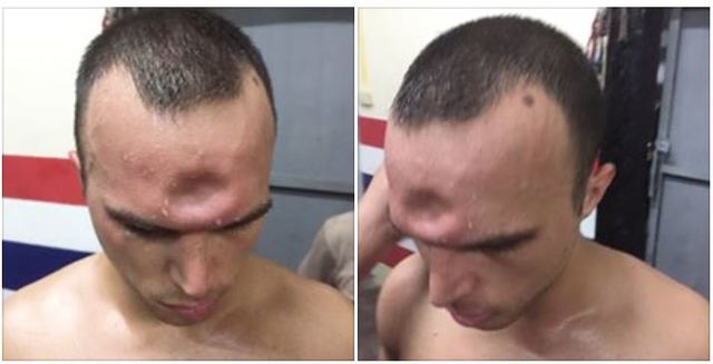 傑若米熬頭凹洞(翻攝臉書)