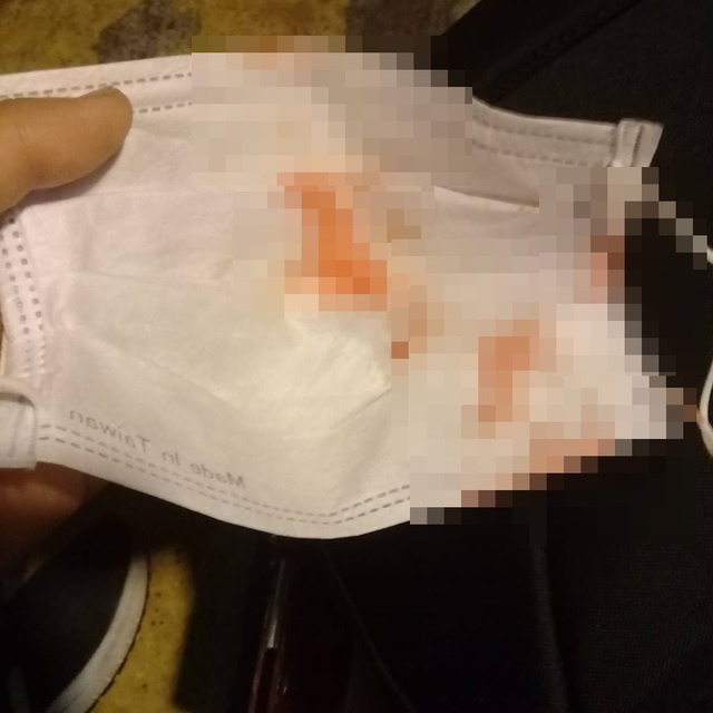 女學生被陌生人毆打，口罩都是血跡。(翻攝奇寶恐龍來了臉書)