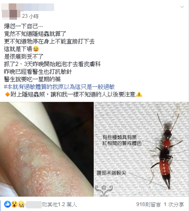 正妹誤打到隱翅蟲，崩潰發勸世照。(翻攝臉書)