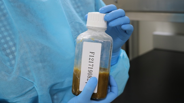 置備後的健康微菌叢（台北榮總提供）