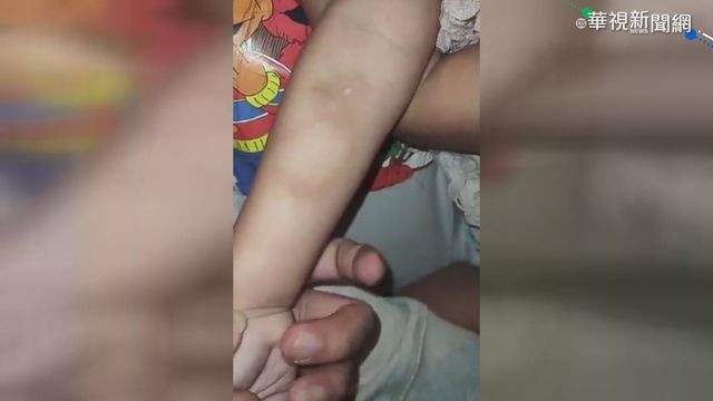 逼母還債 前雇主疑囚禁虐待兩幼女