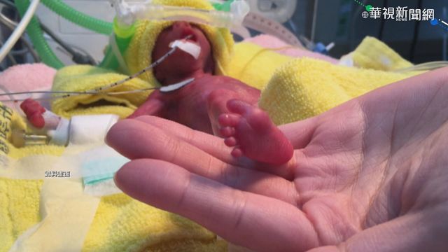 國健署量身訂做 推早產兒健康手札