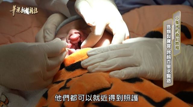 唇顎裂寶寶 跨越百里求醫路｜小兔子的奇幻旅程 ｜華視新聞雜誌