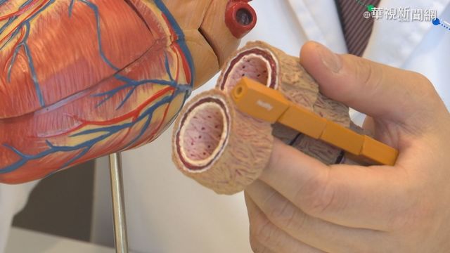 洋蔥清血管?黑木耳治血栓?謠言勿信