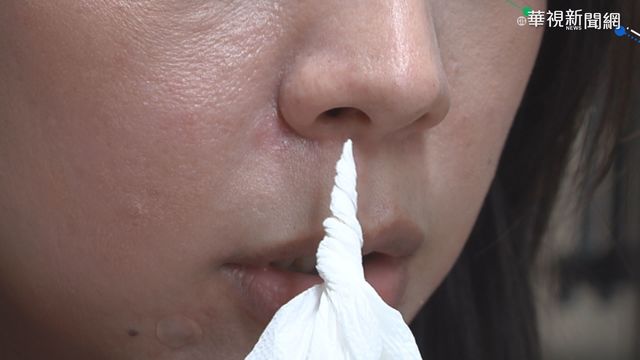 男30年無法打噴嚏 竟是頸椎壓迫害的