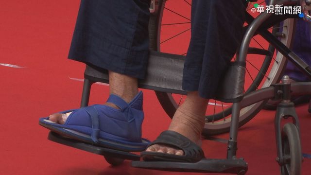 自體脂肪幹細胞 助糖尿病患傷口癒合