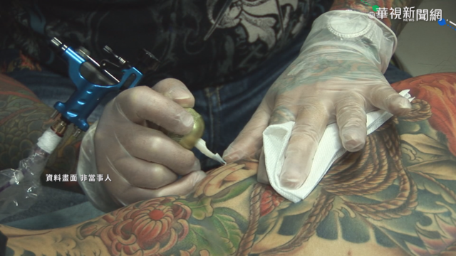 女背部刺青長出腫塊 竟罹基底細胞癌