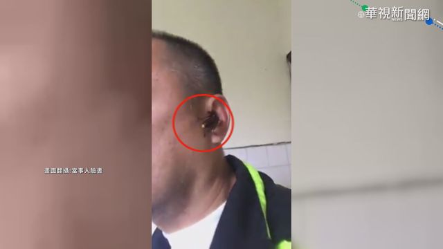 虎頭蜂咬耳朵! 停5分鐘咬掉警一塊皮