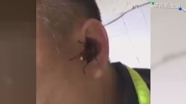 驚! 虎頭蜂咬人 ｢吃｣掉一塊耳朵肉