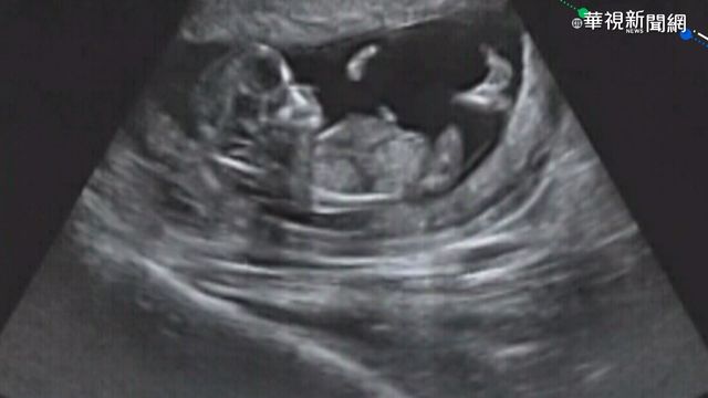 人工流產不用配偶同意！ 明年擬公布「優生保健」修正草案