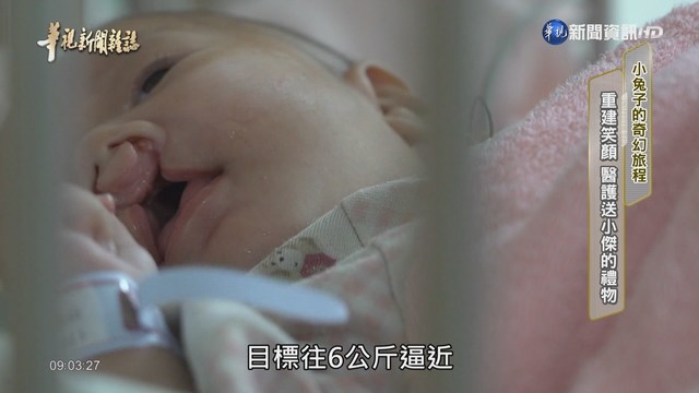 【華視台語新聞雜誌】重建笑顏 醫護送小傑的禮物 小兔子的奇幻旅程