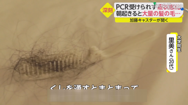 記憶衰退.掉髮 新冠康復者後遺症多