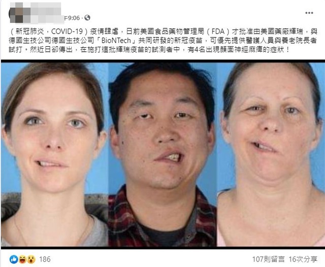 輝瑞疫苗致顏面神經麻痺?! 錯誤訊息別亂傳