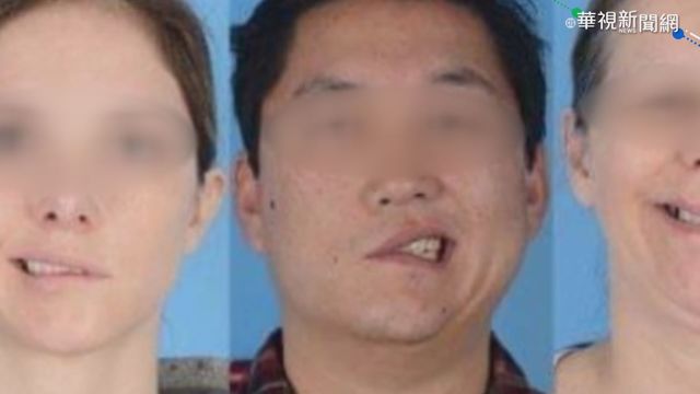 接種疫苗害面癱? 專家:別信網路謠言