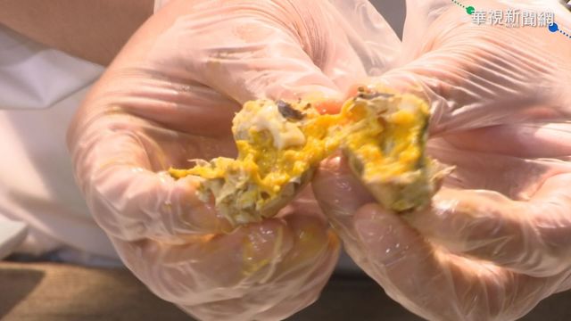 痛風當心! 「高普林」食物控制攝取