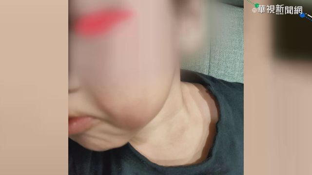 家長疑師持紙捲打童臉頰 幼兒園否認