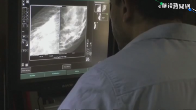 擠下肺癌 世衛:乳癌成全球最常見癌症