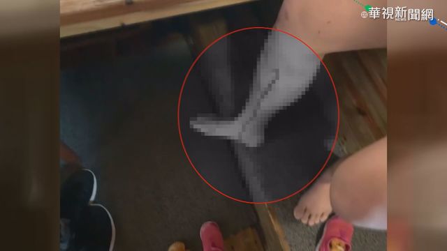 木地板突崩塌 男泡湯遭鐵釘刺傷