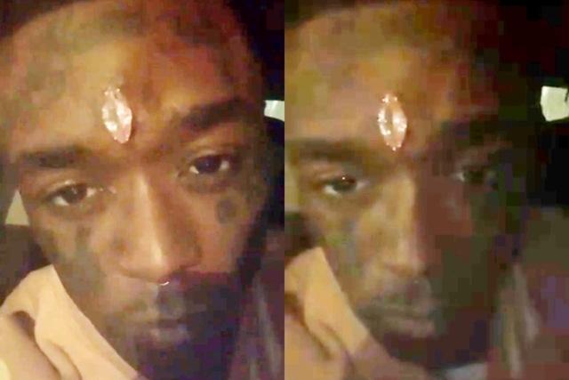 將6.7億巨粉鑽「植入額頭」 美饒舌歌手：已保險！