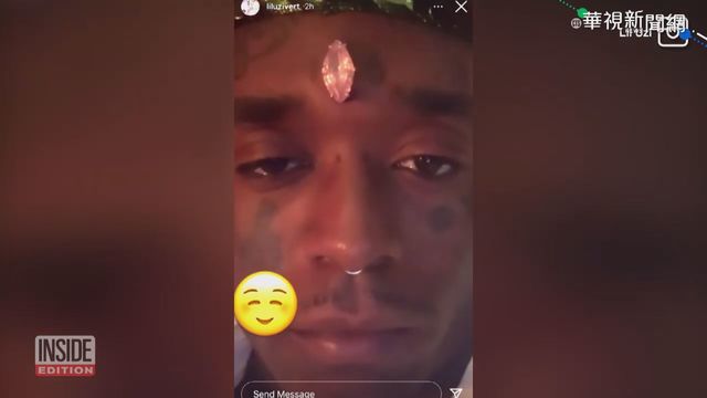 真人版｢幻視｣! 小烏茲弗特額頭鑲粉鑽