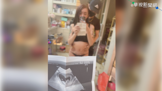 罔腰變性傳有喜 婦產醫曝「男性懷孕4可能」