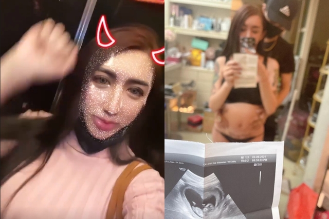 罔腰自曝接受人體試驗懷孕 衛生局初步調查出爐