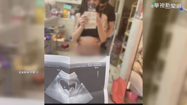 罔腰曬孕婦健康手冊 巧妙遮住姓名