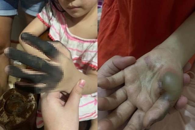 家長當心！女童插插座手指全燒黑 插座安全蓋防悲劇