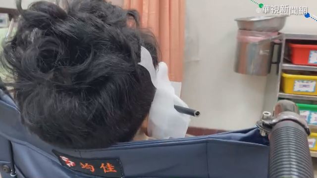 12歲兄玩弓箭 不慎射進7歲弟弟臉頰