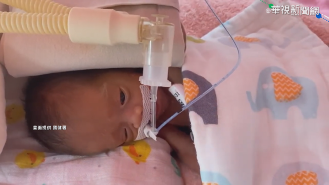 1成新生兒過輕 國健署試辦居家照護