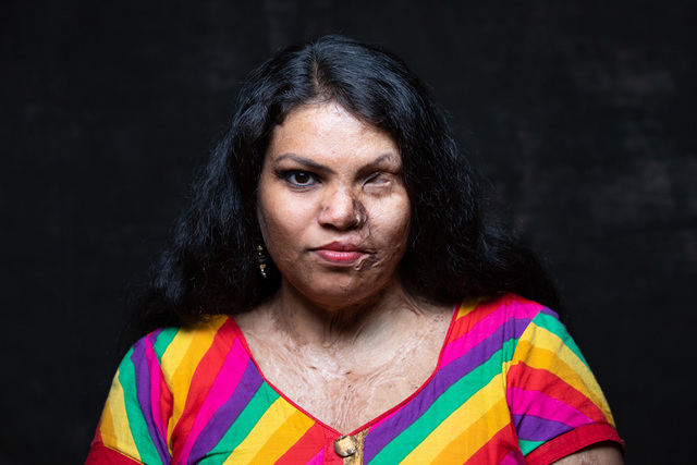 因一包菸被賣掉、遭潑酸 《女也》揭50多國女性之聲