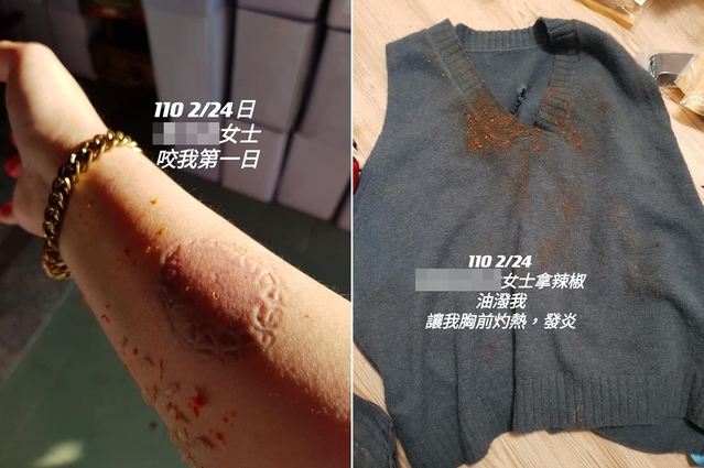 差7歲姊弟戀狂被找麻煩！前空姐怒控「婆婆咬人、潑辣油」