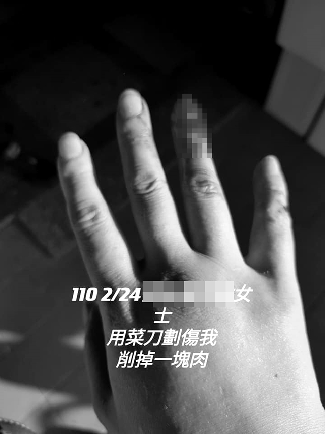 網友貼出被菜刀割傷照片。（翻攝自臉書爆料公社二社）