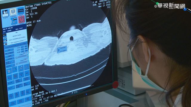 癌症非絕症! 醫:防癌定期篩檢最重要