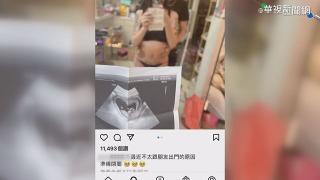 快訊》罔腰懷孕風波落幕 衛福部今宣告結案