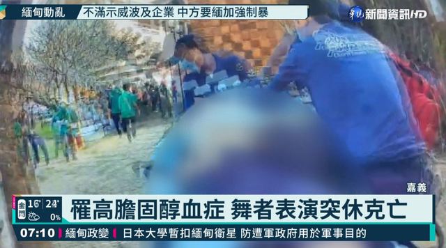 罹高膽固醇血症 舞者表演突休克亡