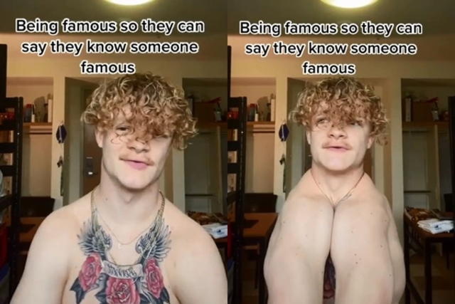 罕見疾病男用肩膀快速拍手 他：天生沒鎖骨