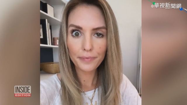 肉毒桿菌打錯位置 美網紅變｢雙面人｣