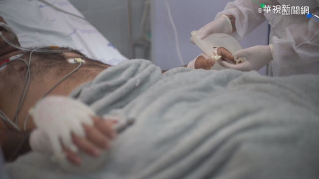 巴西疫情嚴峻 ｢愛的小手｣溫暖陪伴