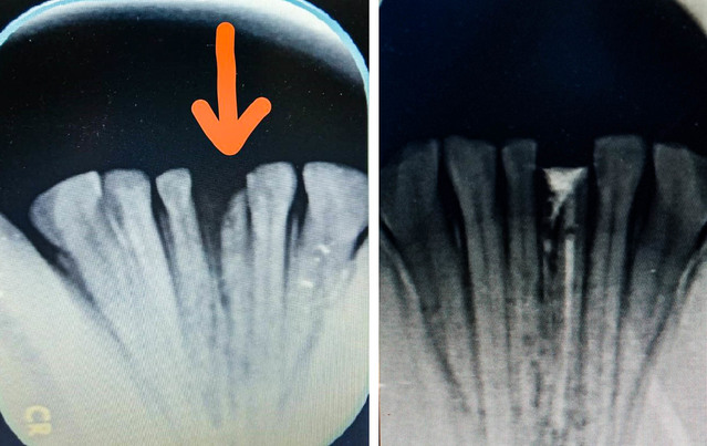（左：治療前、右：治療後。／台北市立動物園提供。）