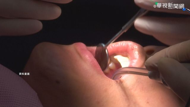牙周病患高風險? 研究:新冠死亡率高9倍